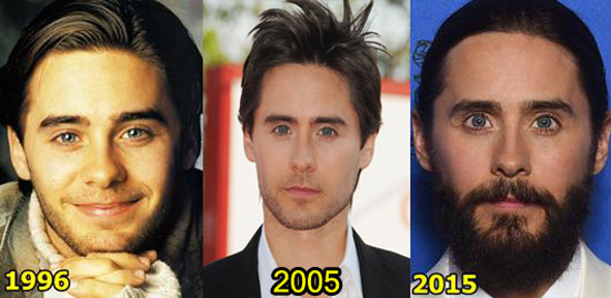Jared-Leto-Plastic-Surgery-Before-and-After-Botox