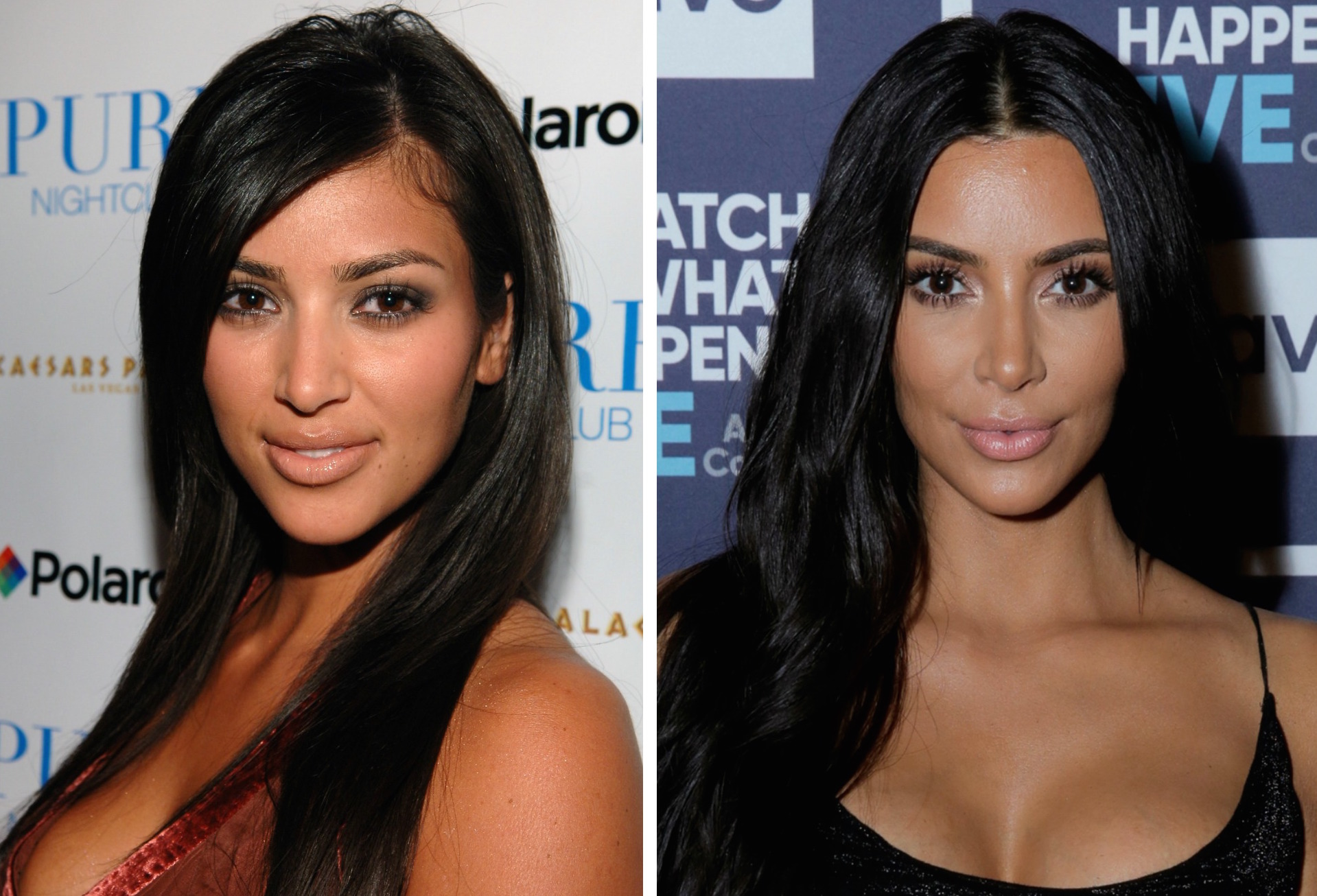 kim-kardashian-before-and-after-plastic-surgery