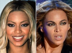 Beyonce-nose-job